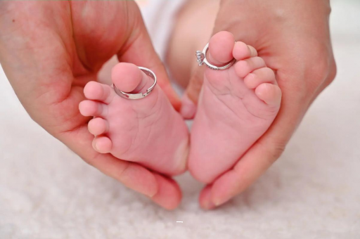 射阳孕妇怎样预防妊娠纹